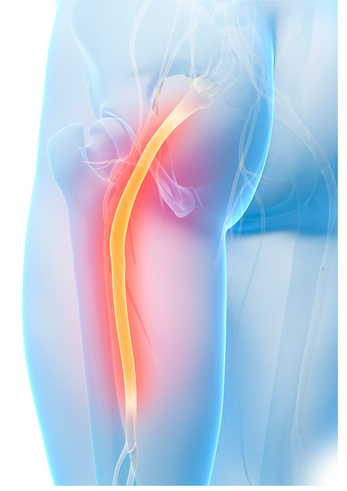 sciatique-jambe-droite-symptomes